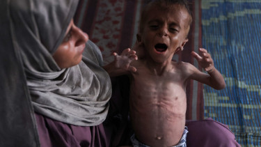 Almost a third of Gazans 'not eating for days': UN agency