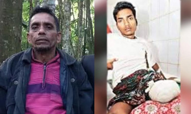 Father of Limon, who lost leg in RAB shooting, assaulted in Jhalokathi