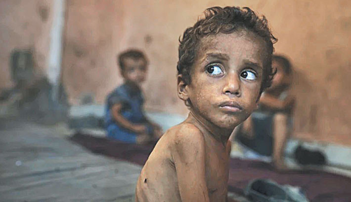 Dozens of kids in Gaza starved to death in July as hunger surges