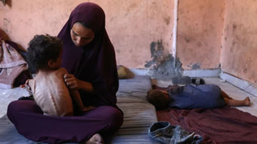 Amid Gaza famine, Palestinian girl struggles to survive