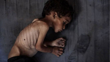 'Starving Gaza children too weak to cry'