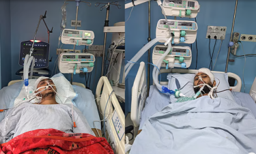 Two injured students on life support, one transferred to Dhaka