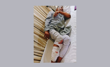 JAGPA president hacked in capital