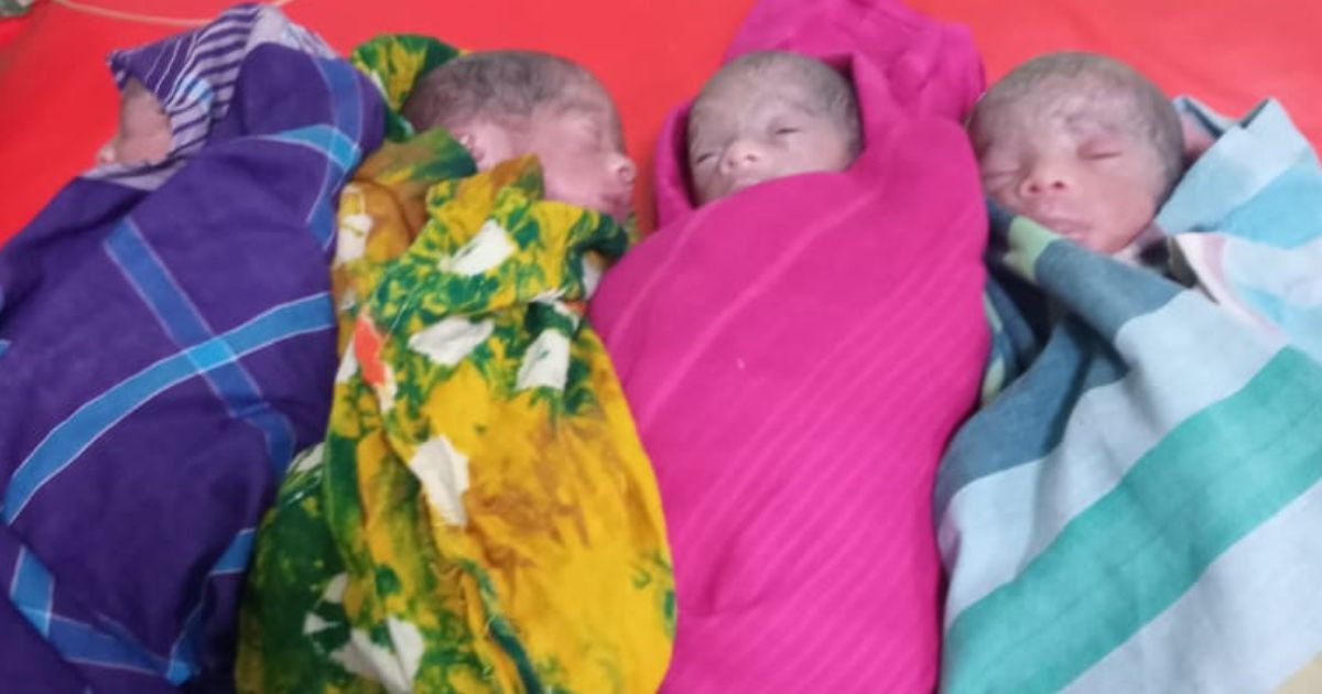 Woman delivers sextuplets at DMCH