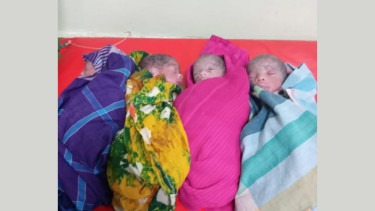 Woman delivers sextuplets at DMCH, all six babies survive