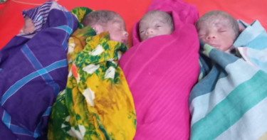 Woman delivers sextuplets at DMCH