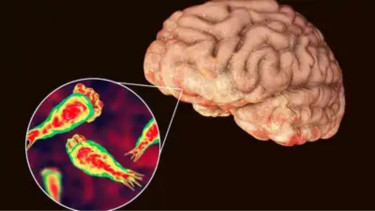 India health alert after 'brain-eating' amoeba rise