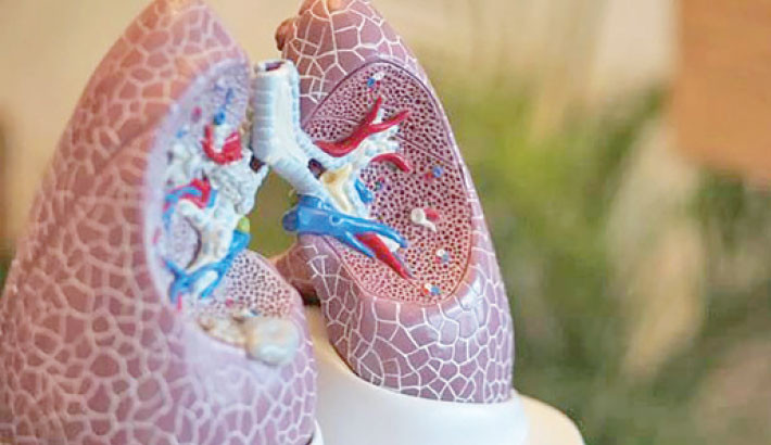 Severe obesity causes lungs to age prematurely: Study