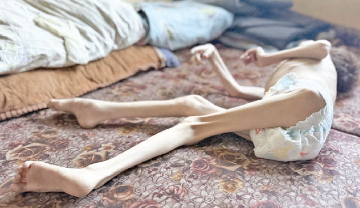 Starvation in Gaza: Death by Design