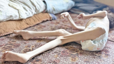 Starvation in Gaza: Death by Design