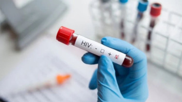 Alarming rise in HIV/AIDS cases in Sirajganj; 255 infected this year