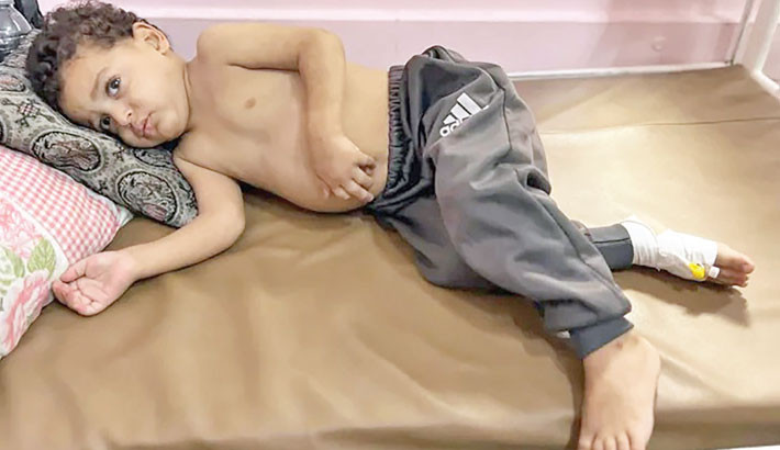 Gaza children dying as they wait for Israel to enable evacuations